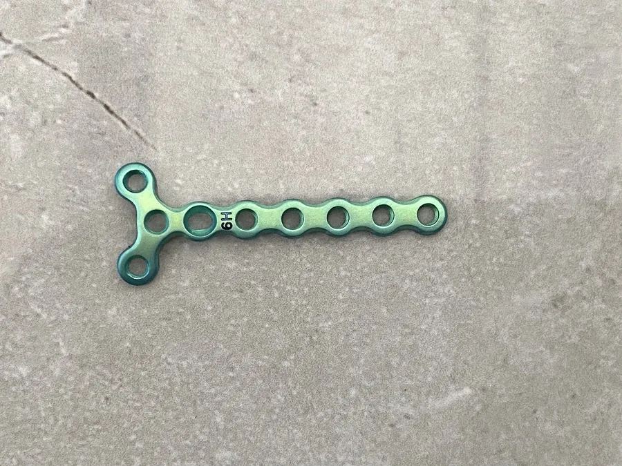 1.5S Mini Y Locking Plate