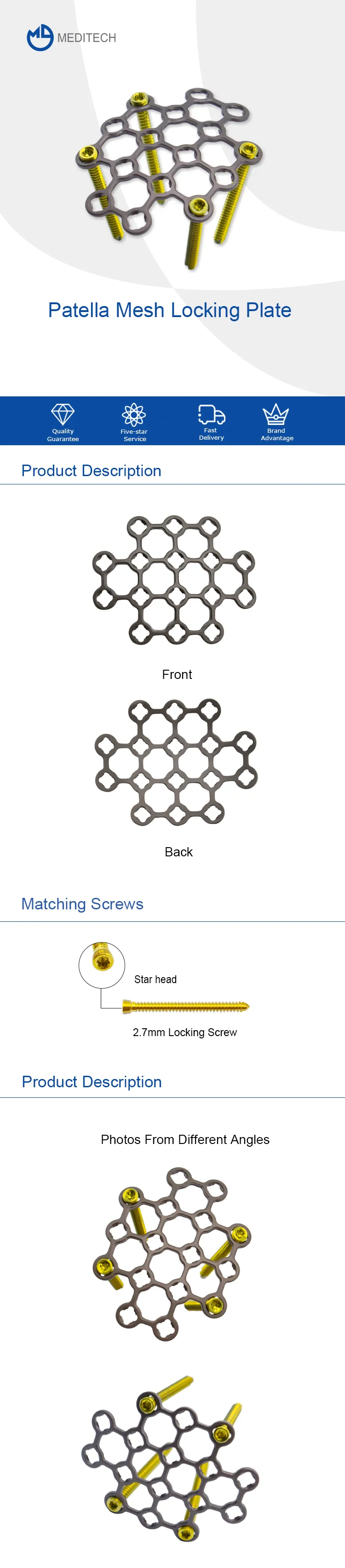 Patella mesh nga plato nga pagkandan .