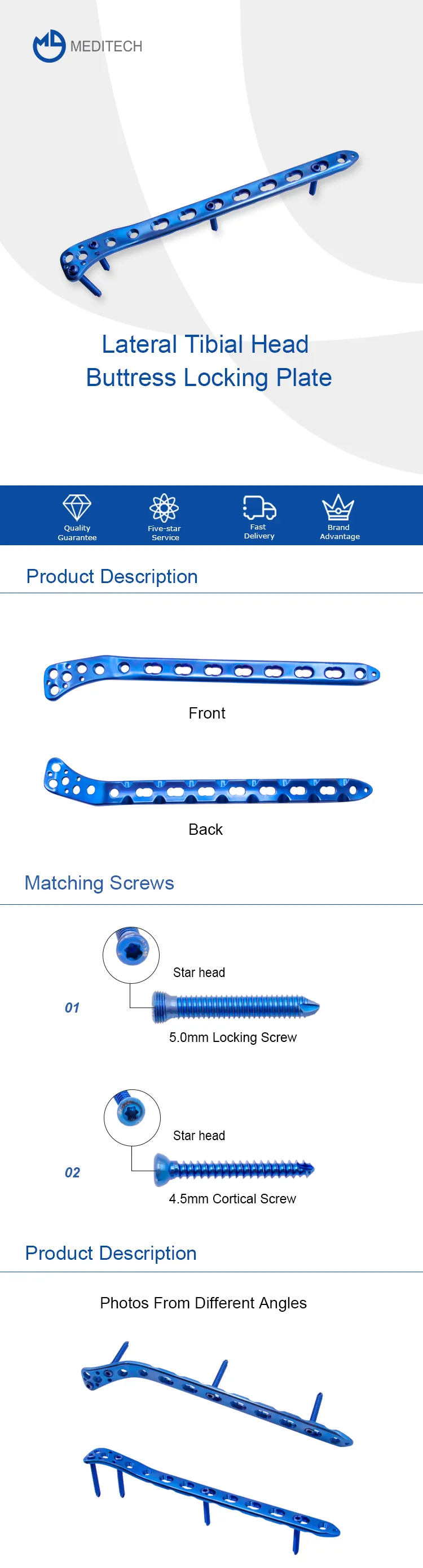 Lateral nga tibial nga ulo nga buttress nga pagkantan nga plato .